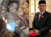 Anggota DPRK Aceh Barat Ajak Masyarakat Bantu Ade Cahaya